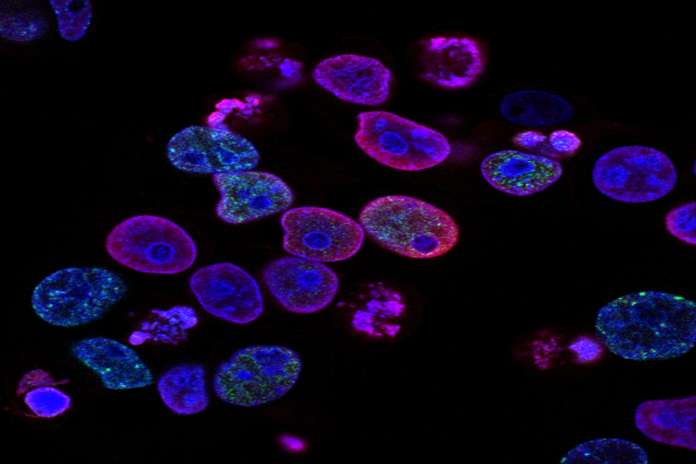 57 1 CyGenica Limited Secures USFDA Approval for Orphan Drug Designation for Novel Drug Conjugate in Glioblastoma Multiforme Treatment